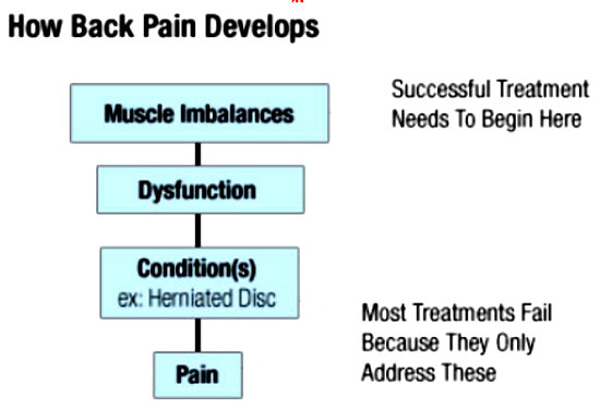 diagram concerning sciatic nerve pain development